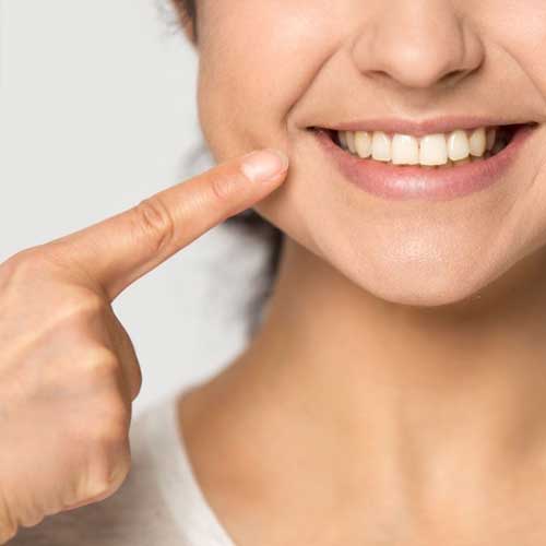 Benefits of teeth braces