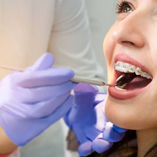 Get braces treatment in zirakpur by smilewide dental