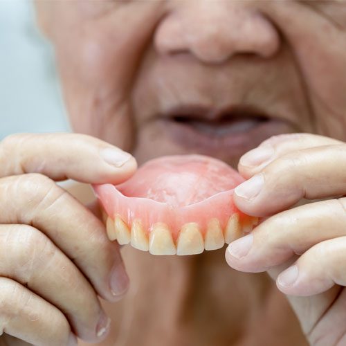 Dentures in Zirakpur