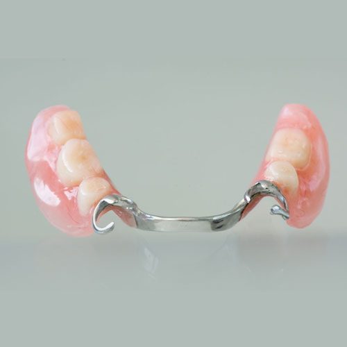 Partial Dentures in Zirakpur