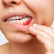 Frame 22 (4) common symptoms of tooth decay.