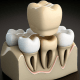 "Various types of dental crowns including porcelain, metal, and zirconia on a textured background."