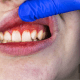 Illustration of a confident smile with healthy gums, symbolizing effective gum disease treatment options.