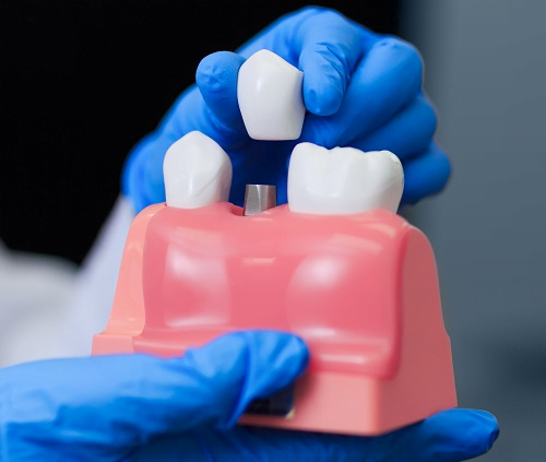 How to spot good dental products in the supermarket