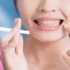The Impact of Smoking on Dental Health