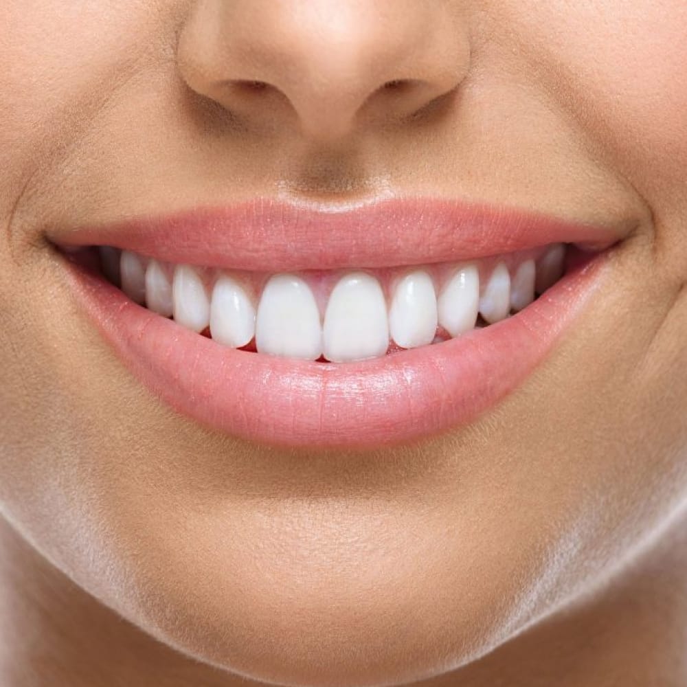 Full Mouth Rehabilitation