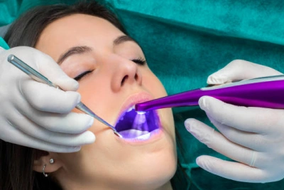 Sealants For Teeth