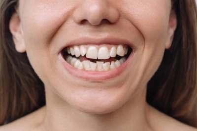 Treatment for Knocked-Out Teeth